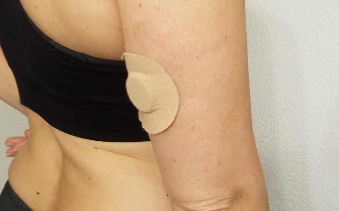 Continuous Glucose Monitor (CGM): Key Metrics to Track