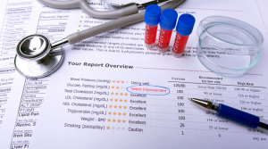 Test Results