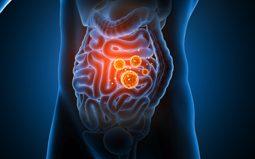Balancing the Microbiome: Overcoming Gut Microbial Dysbiosis
